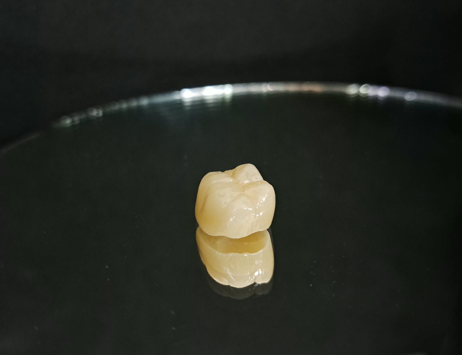 Corona de zirconio monolítica